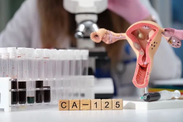 High CA125 After Hysterectomy